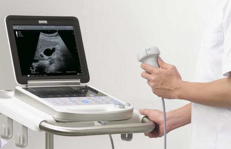 写真：超音波画像診断装置
